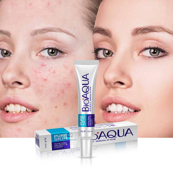 Pack of 2 Mistine Acne Clear Facial Foam and Bioaqua Acne Cream