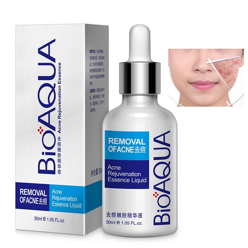 Bioaqua Anti-Acne Serum Removal Of Acne Essence Liquid 30ML BQY0726