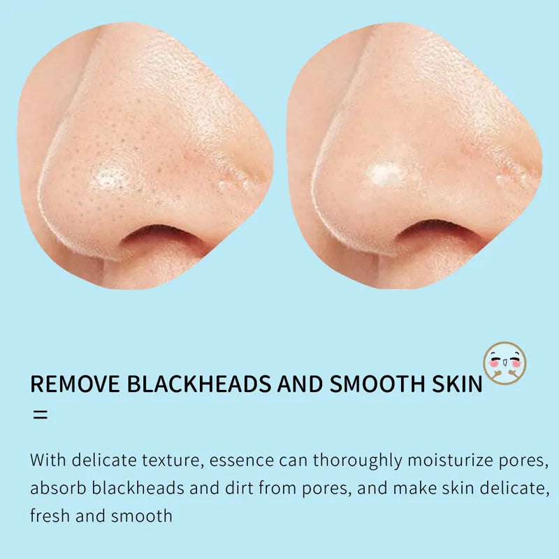 Images Clear Skin Dispel Blackhead Peel Off Nose Mask