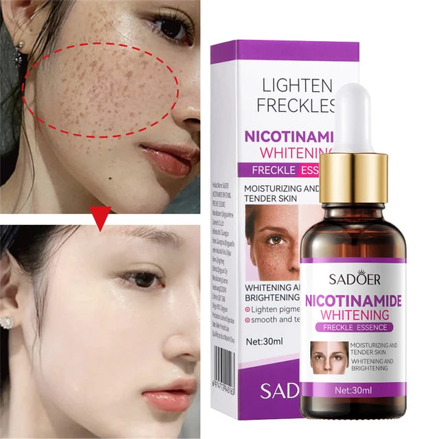 SADOER Nicotinamide Whitening Freckles Serum 30ml | BIOAQUA Pakistan
