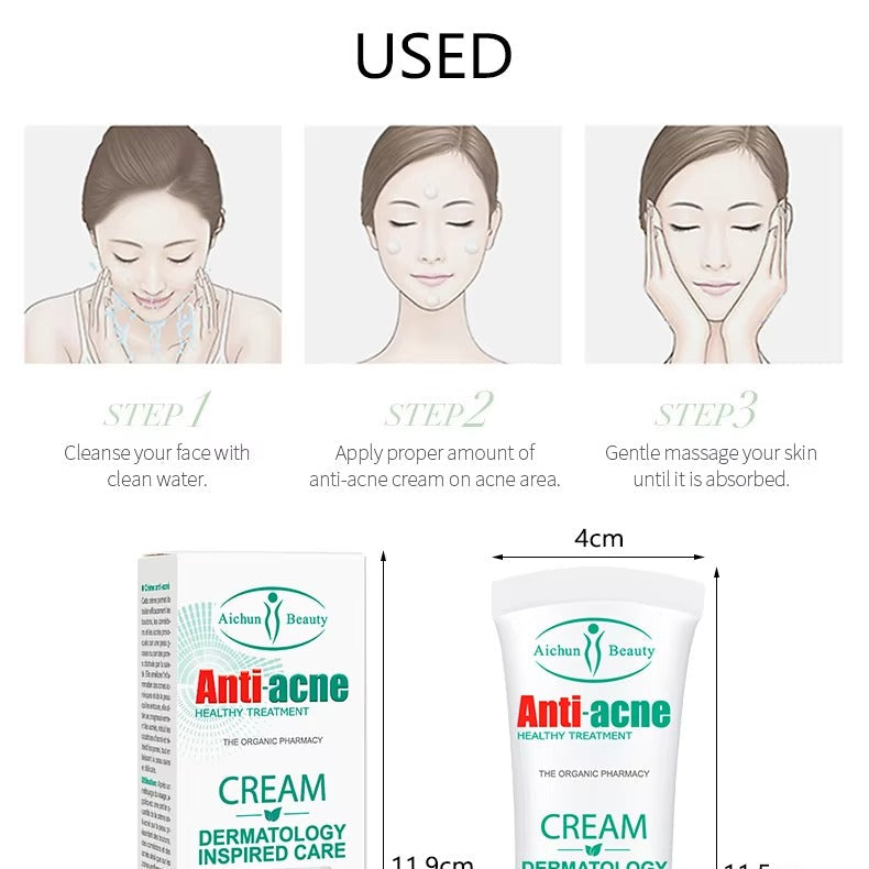 Anti-acne cream packaging and usage steps on a white background