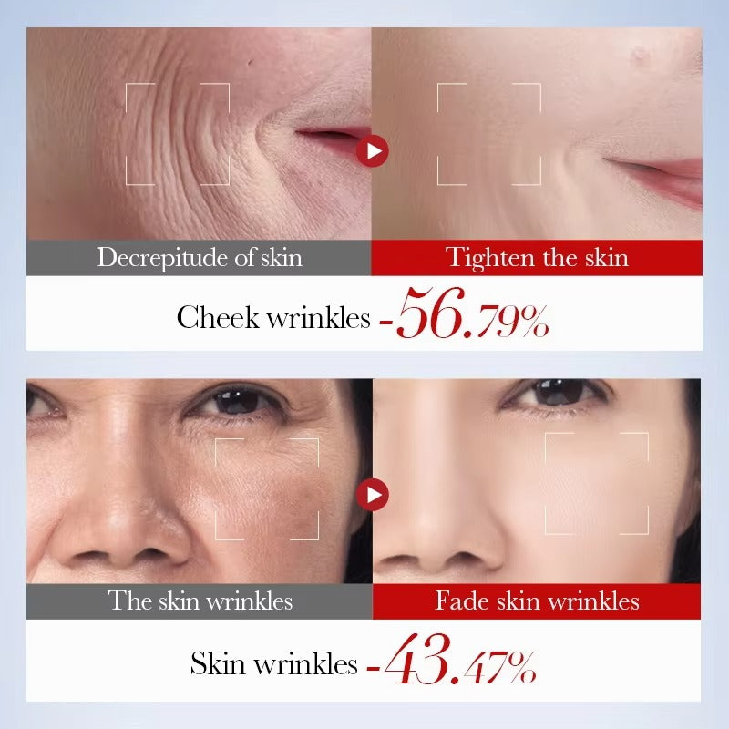 Before and after comparison of skin treatment effects on wrinkles.