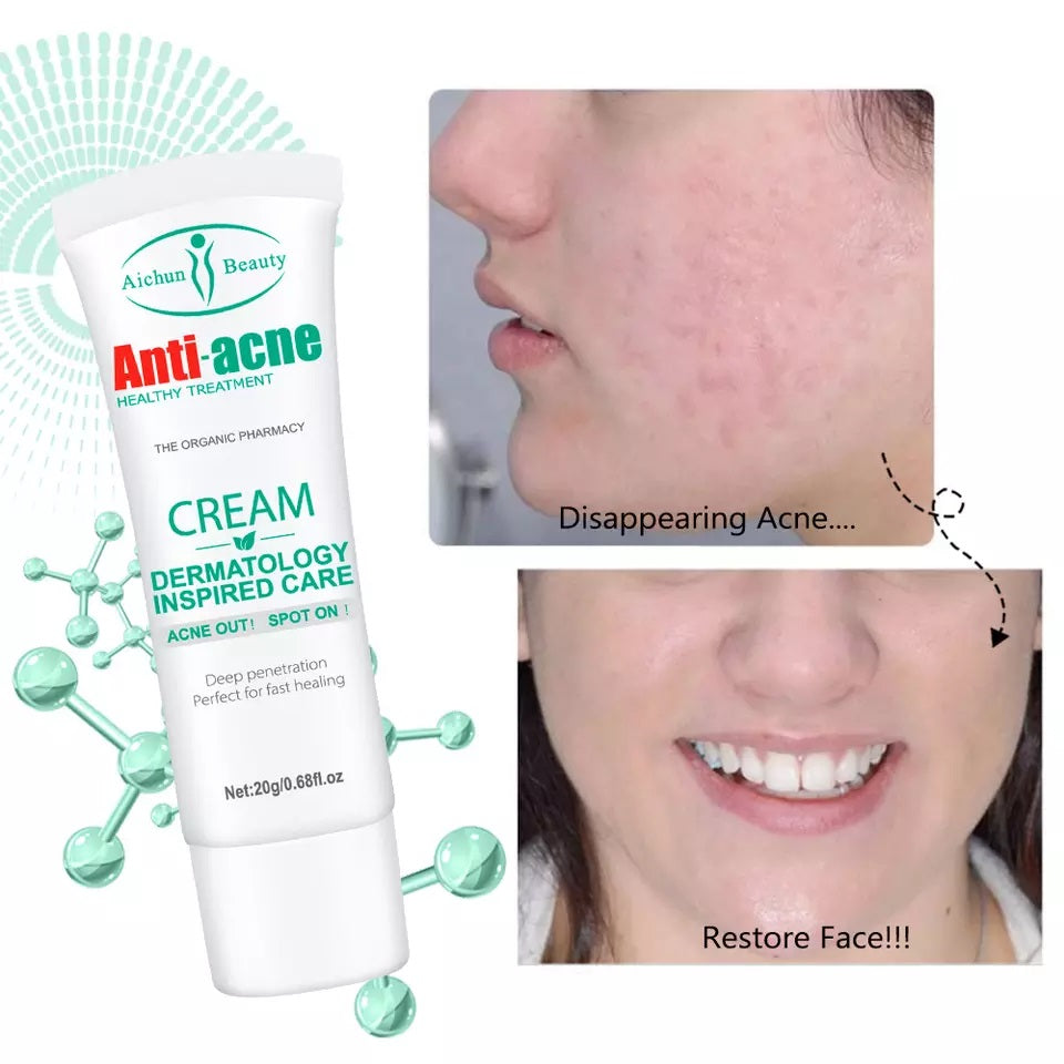 Aichun Beauty Acne Remove Anti Acne Face Cream 20g