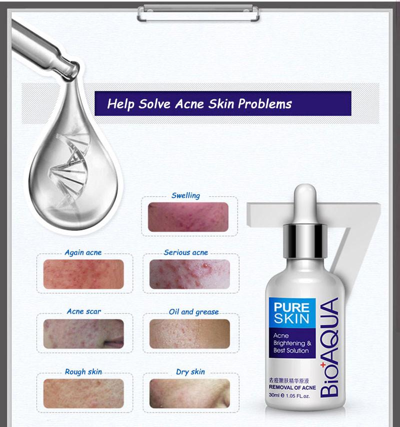 Bioaqua Anti-Acne Serum Removal Of Acne Essence Liquid 30ML BQY0726