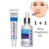 BIOAQUA Anti Acne Serum & Cream Set 2pc for Oily Skin